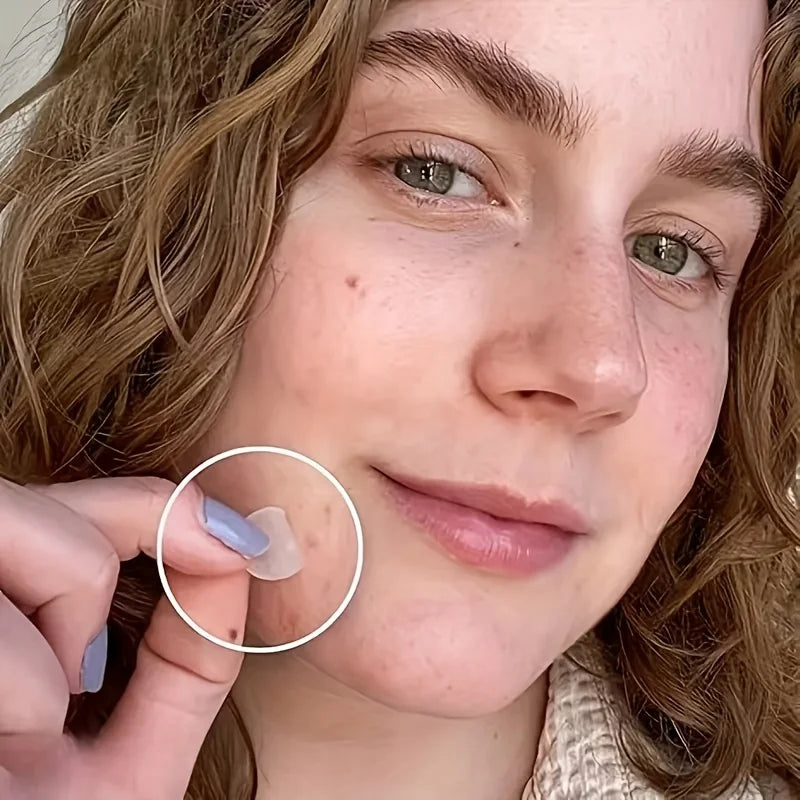Skin-Calming Acne Patches - Hydrocolloid Technology Gently Heals Blemishes, invisibleProtection.